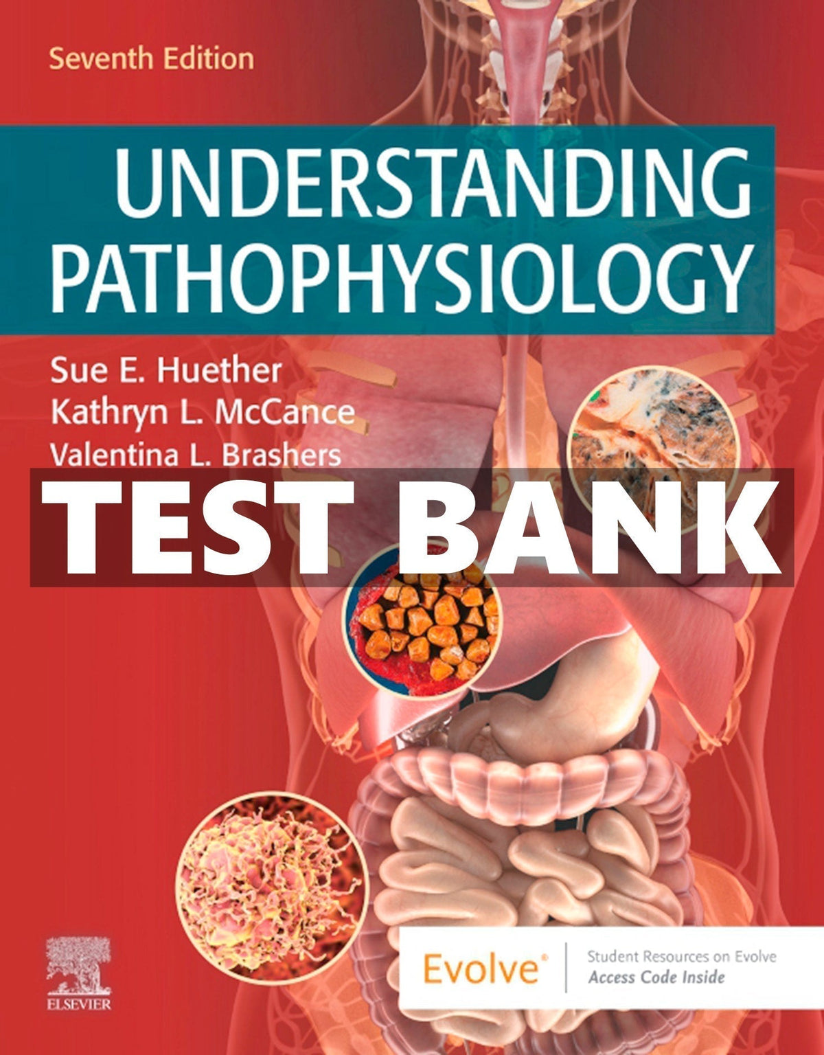 Testbank Understanding Pathophysiology, 7. Auflage von Sue E. Huether, Kathryn L. McCance und Kelly J. Brashers